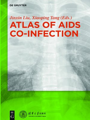 cover image of Atlas of AIDS Co-infection